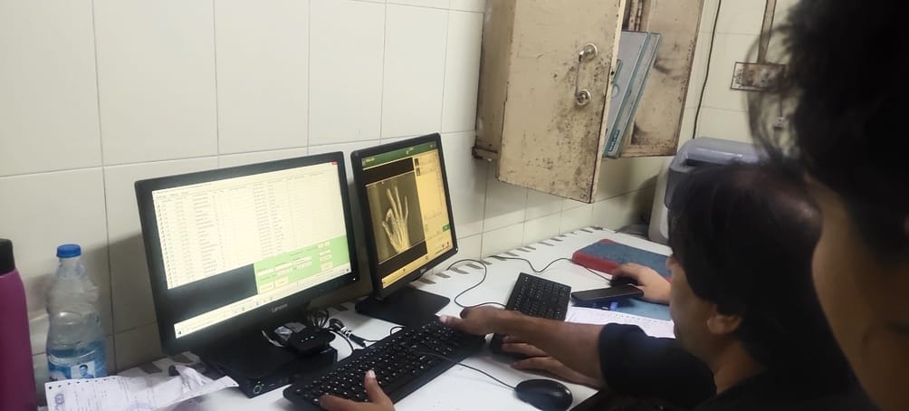 X-ray film finished, report available on mobile