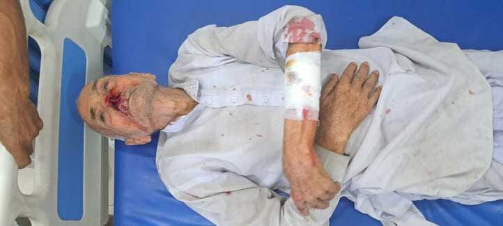 Elderly man injured after being attacked by a group of monkeys