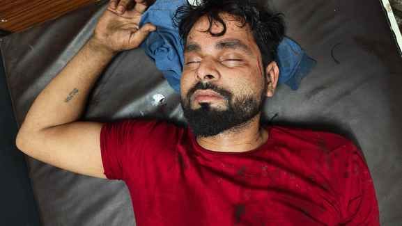 Firing and stone pelting in a case dispute injured a youth.