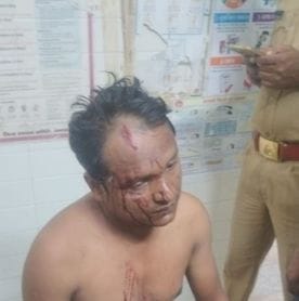 unnao news