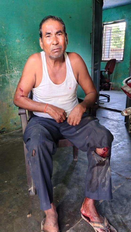 Leopard attacks bike, grandmother, granddaughter and bank employee injured, critical