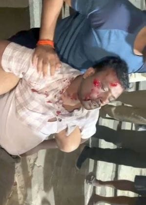 Another explosion occurred at the site, the accountant was injured, and the body of his sister-in-law was found in the rubble