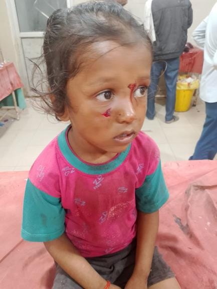 Four people, including a woman and children, were injured by a monkey in Jaura Bazaar.