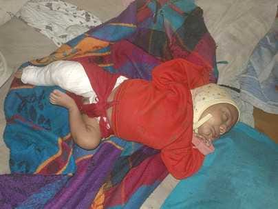 Siddharthnagar News: Due to negligence of doctors in a private hospital, the newborn's leg got broken during delivery