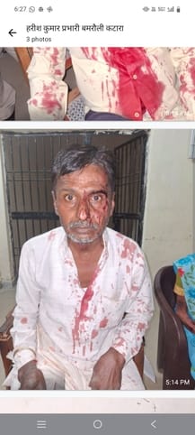 Stone pelting between two groups in Jharpura, 10 injured, 8 arrested, one seriousStone pelting between two groups in Jharpura, 10 injured, 8 arrested, one serious