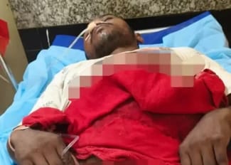 A young man who tried to intervene was attacked with a knife, his condition is critical.