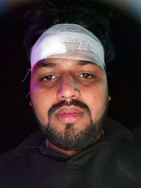 Scooty skids while trying to save an innocent child, youth injured
