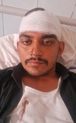 BJP leader's family attacked in Fatehpur