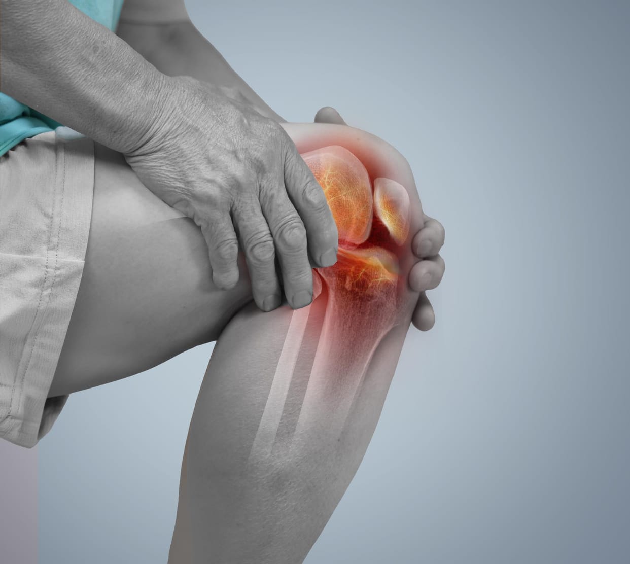 Controlling obesity can help relieve arthritis