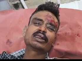 A young man was brutally beaten while being held hostage, his nails pulled out with a spade.