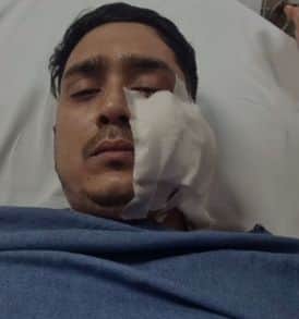 Gwalior News: A friend was shot during a dispute between two brothers