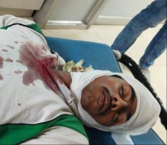 Student attacked outside school, head torn