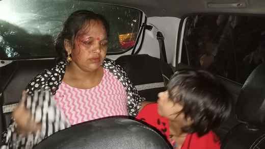 Seven bike riders fell due to mud on the highway, five people were injured.