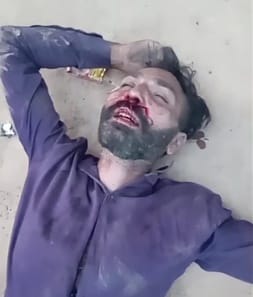 Youth injured in a fight in Kasampur Machhra