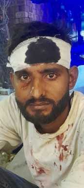 Fight in Kapsad due to enmity, one injured