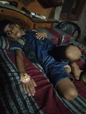 Fever spreads in Khudna Vaidya, woman dies, 60 fall ill
