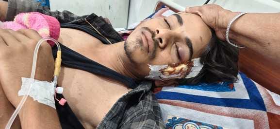 Bullies beat up a young man, his condition is critical
