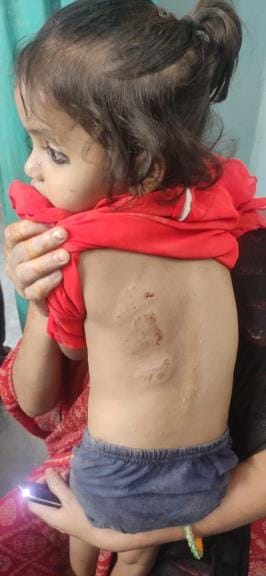 A dog attacked a girl playing outside her house.