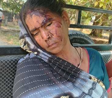 After allegations of theft, two groups clashed with sticks and sticks, injuring eight people