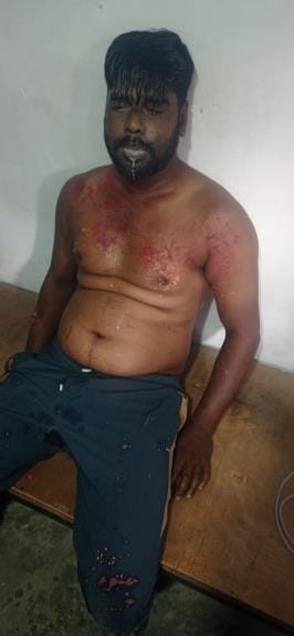 Jeweller throws acid on customer, eight suffer burn injuries