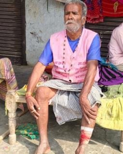 Four people, including an elderly couple, were injured in wild animal attacks.