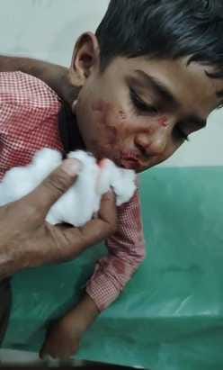 14 injured in stone pelting over egg cart dispute
