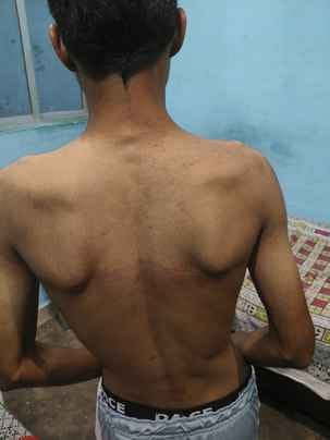Student sets off firecrackers in school, father alleges son was beaten