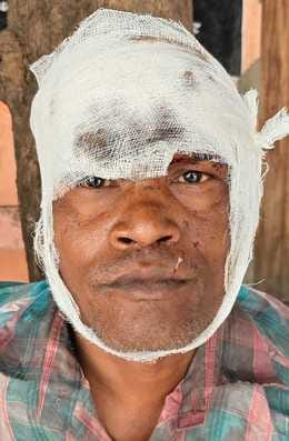 A father and son attacked a young man with a knife and a stick.