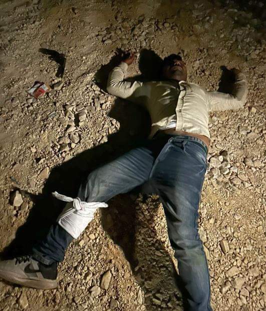 कोतवाली देहात के पखरौली रेलवे क्रॉसिंग के पास पुलिस की गोली लगने से घायल पड़ा मुकेश। 