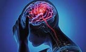 Drug users have a higher risk of stroke