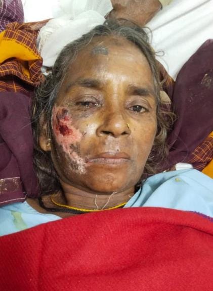 Woman found injured in Ursula Hospital patient's clothes, head injury