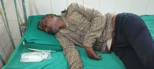 The person was referred to the medical college in critical condition