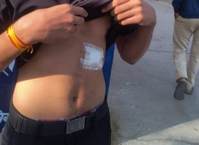 History-sheeter attacked two students with a knife, case registered