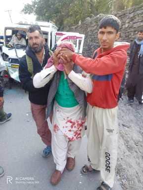 पुंछ जिले की मंडी तहसील के लारेन सड़क मार्ग पर आटो की भिंडंत मं घायल को अस्पताल लाते लोग