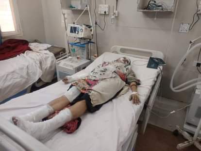 Mother and daughter suffer burn injuries in cylinder fire, daughter-in-law's parents accused of arson