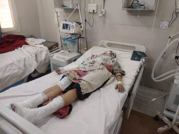 Mother and daughter suffer burn injuries in cylinder fire, daughter-in-law's parents accused of arson
