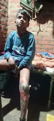 A 13-year-old boy threw a burning petrol bottle at a boy, injuring him.