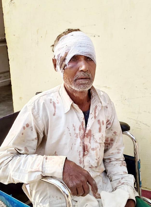 Daughter-in-law broke father-in-law's head with a rod