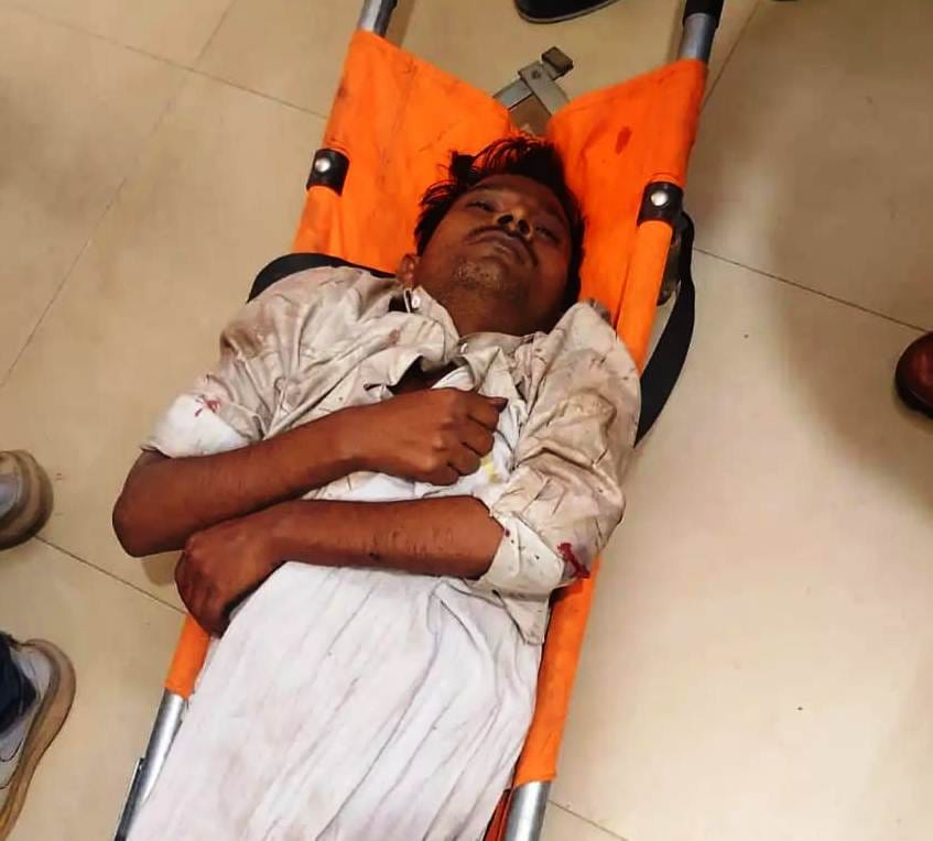 Youth's legs chopped off by Tanakpur-Achhnera Express