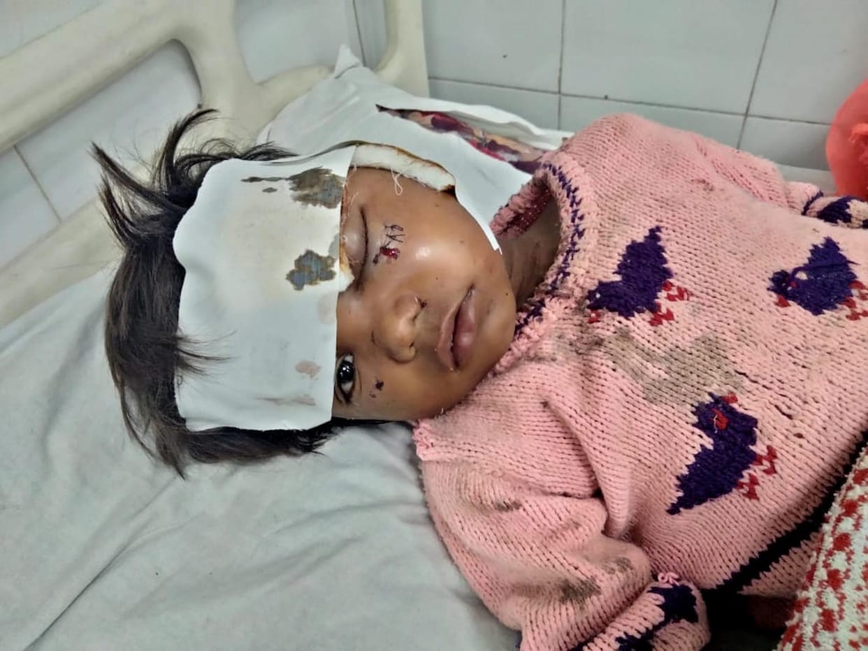 Wild animal attacks boy warming himself in Tepara village, critical