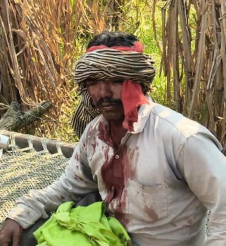 Farmer fights with leopard to save goat