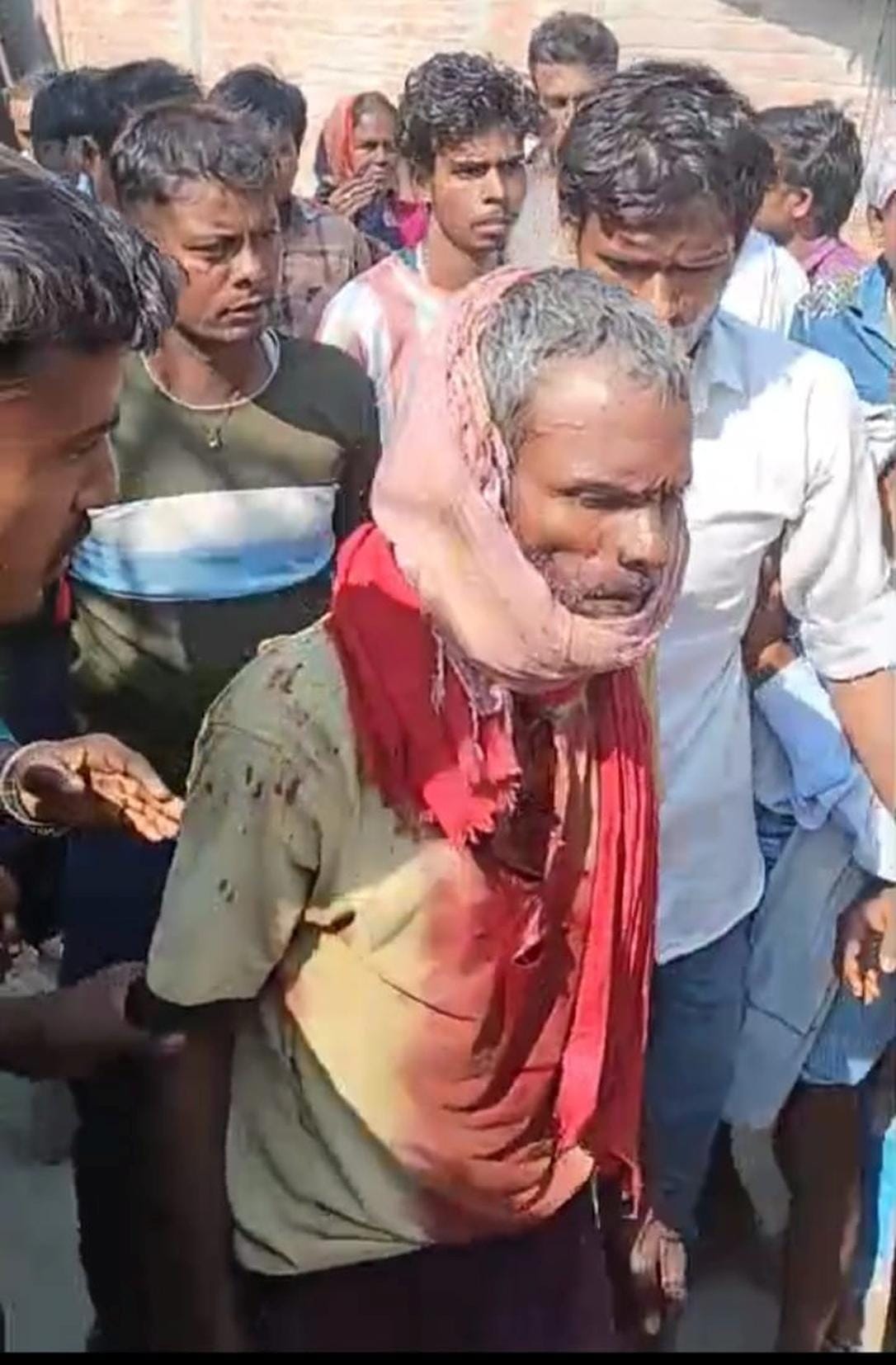 Leopard attacks farmer, condition critical