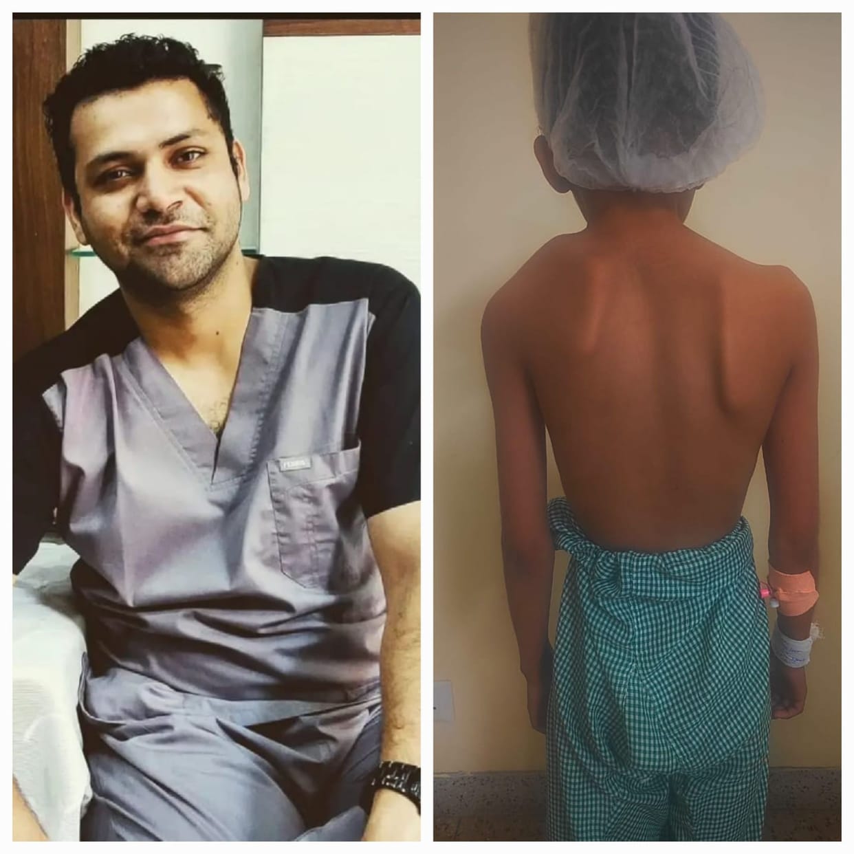 Successful surgery for congenital shoulder deformity at Tanda Medical College