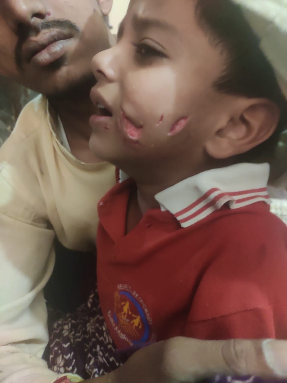 A five-year-old boy who went to the farm with his father was bitten by a dog.