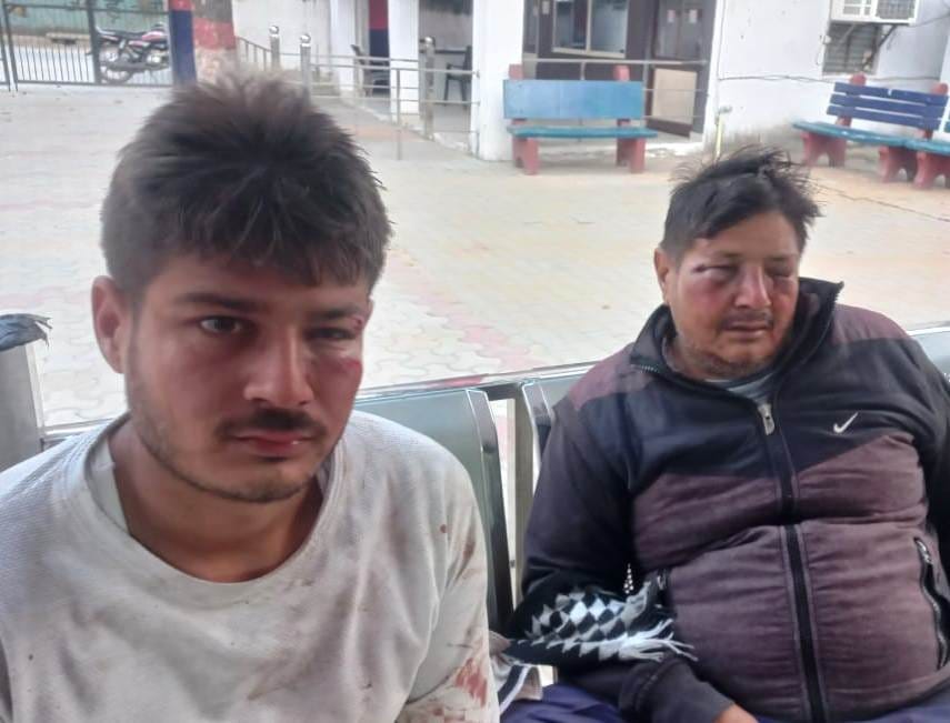 Father and son beaten up on farm, seriously injured
