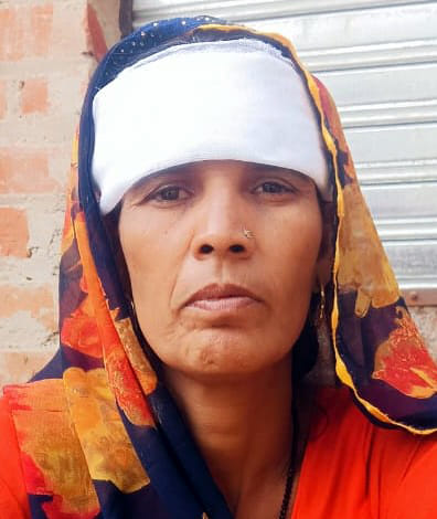 A wild animal attacked women sleeping in the veranda, three injured.
