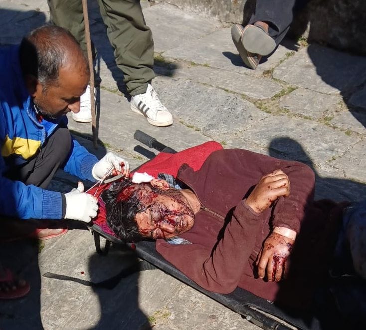 Three bears attack a youth in Jaikot, Dharchula; his condition is critical.