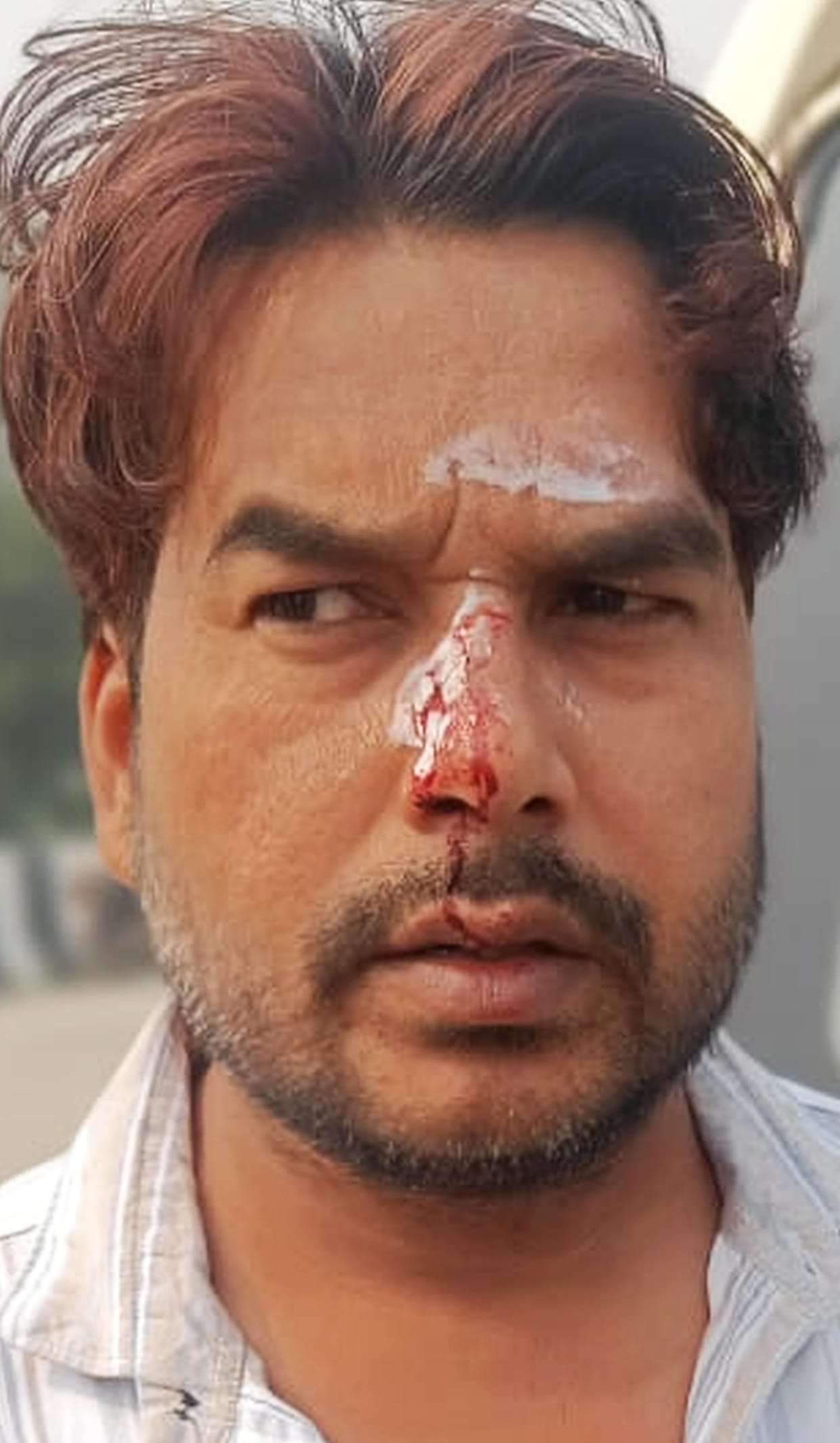 Mother and son travelling in Scorpio injured in road accident