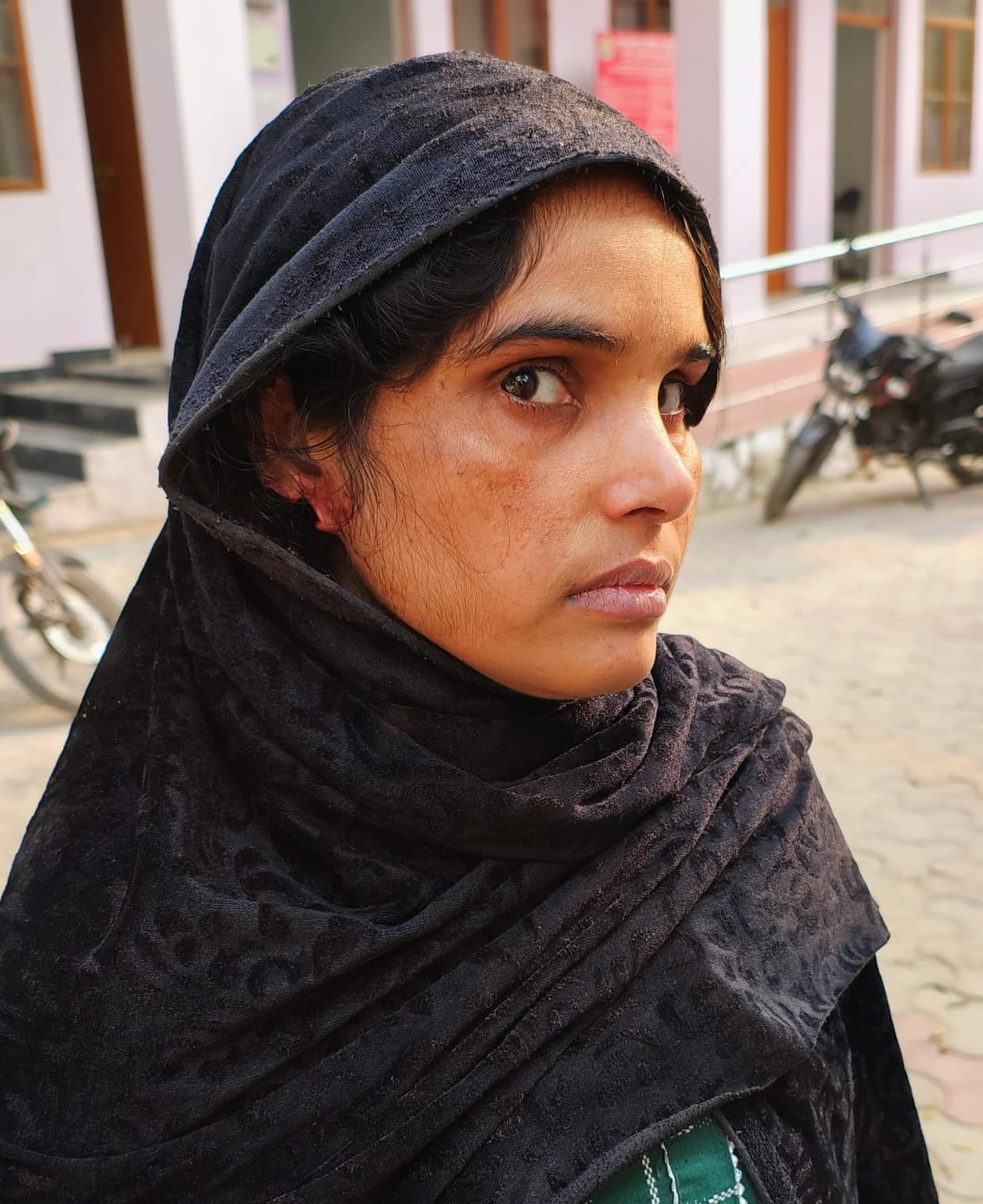 Brother-in-law cuts off woman's ear due to enmity