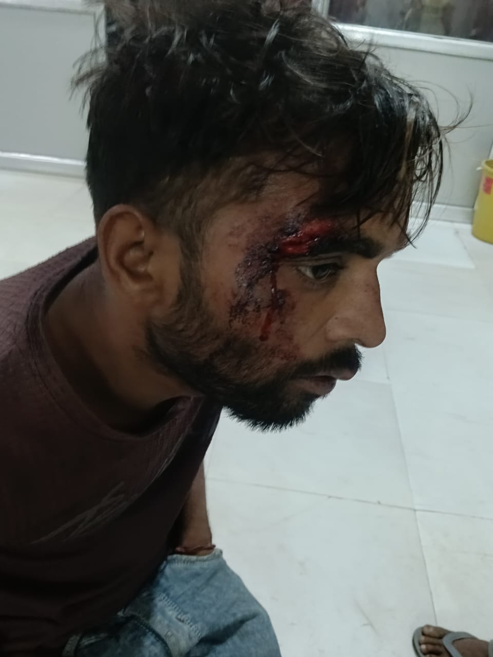 Attack and stone pelting in protest against playing DJ, six injured
